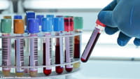Exame de sangue detecta volta do câncer