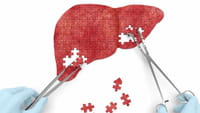 Remédio para hepatite C será feito no Brasil