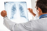 App brasileiro auxilia análise de radiografias