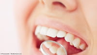 Estudo: aspirina regeneraria dente após cárie