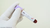 Sobrevida de paciente com Aids dobra no Brasil