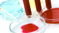 Cientistas criam teste de HIV em pendrive