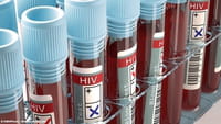 HIV: novos anticorpos atacam até 99% dos tipos