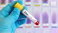 Estudo: zika pode causar problemas cardíacos