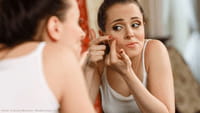 Acne pode fazer bem para a pele, diz estudo