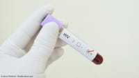 Teste rápido de HIV chega às farmácias do Brasil