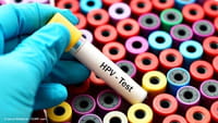 Mais da metade dos jovens brasileiros têm HPV