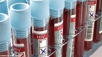 Vacina contra HIV pode entrar em fase clínica