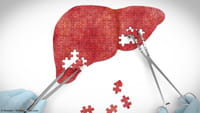 Surto de hepatite A interrompe queda da doença