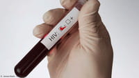 Revelado segundo caso de cura da Aids