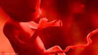 Útero artificial pode ajudar bebês prematuros