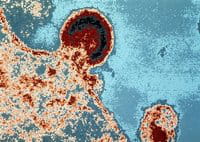 A imagem de microscópio mostra o vírus da Aids atacando um linfócito A imagem de microscópio mostra o vírus da Aids atacando um linfócito