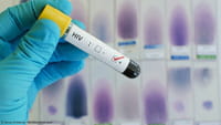 Vacina contra HIV consegue proteger macacos