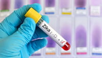 OMS declara fim de emergência por zika