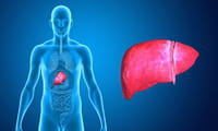 Esteatose hepática afeta 30% da população