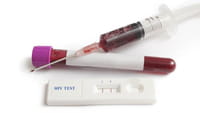 Queda de 36% na transmissão materna do HIV