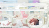 Microcefalia: mortalidade é quatro vezes maior