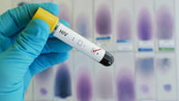 Uma em 10 crianças com HIV é imune à Aids